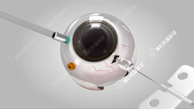 广州眼科手术动画