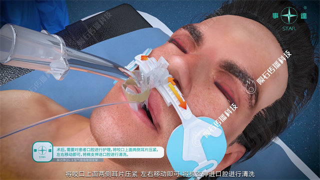 医疗器械操作动画：气管插管固定架操作演示